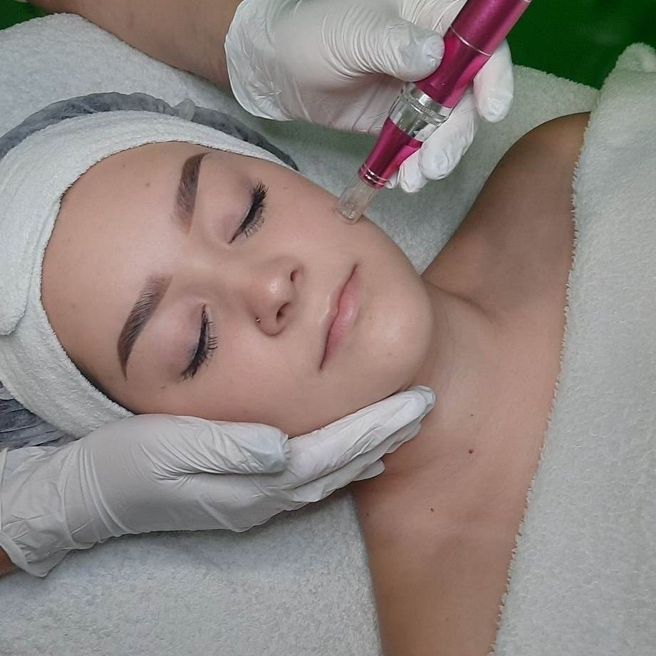 Zabieg dermapenem
